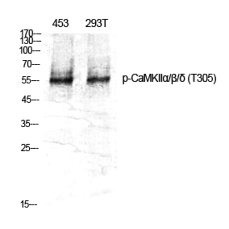 Western Blot - Anti-CaMK2 alpha + beta + delta (phospho Thr305) Antibody (A0005) - Antibodies.com