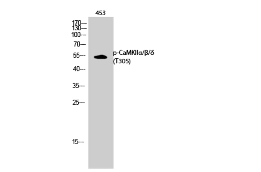 Western Blot - Anti-CaMK2 alpha + beta + delta (phospho Thr305) Antibody (A0005) - Antibodies.com