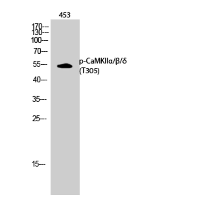 Western Blot - Anti-CaMK2 alpha + beta + delta (phospho Thr305) Antibody (A0005) - Antibodies.com