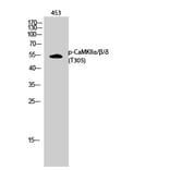 Western Blot - Anti-CaMK2 alpha + beta + delta (phospho Thr305) Antibody (A0005) - Antibodies.com