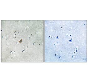 Immunohistochemistry - Anti-EPHA3 + EPHA4 + EPHA5 (phospho Tyr779 + Tyr833) Antibody (A8095) - Antibodies.com