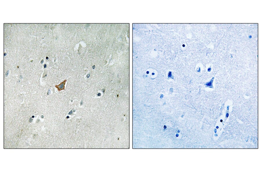 Immunohistochemistry - Anti-EPHA3 + EPHA4 + EPHA5 (phospho Tyr779 + Tyr833) Antibody (A8095) - Antibodies.com