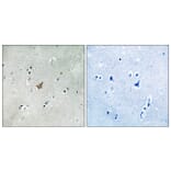 Immunohistochemistry - Anti-EPHA3 + EPHA4 + EPHA5 (phospho Tyr779 + Tyr833) Antibody (A8095) - Antibodies.com