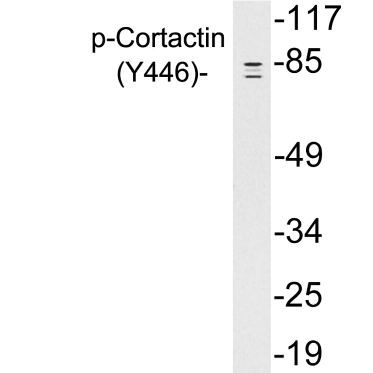 Western Blot - Anti-Cortactin (phospho Tyr446) Antibody (P12-1016) - Antibodies.com