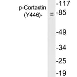 Western Blot - Anti-Cortactin (phospho Tyr446) Antibody (P12-1016) - Antibodies.com