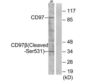 Western Blot - Anti-CD97 beta (cleaved Ser531) Antibody (L0192) - Antibodies.com