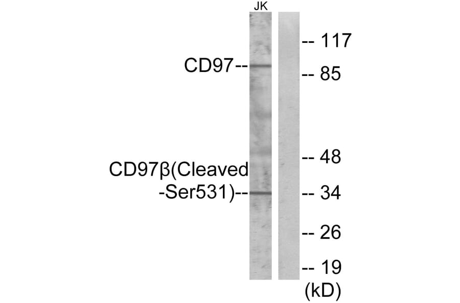 Western Blot - Anti-CD97 beta (cleaved Ser531) Antibody (L0192) - Antibodies.com