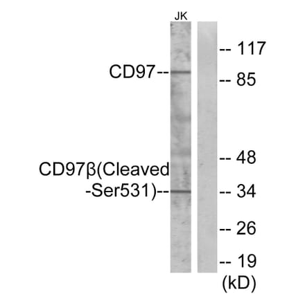 Western Blot - Anti-CD97 beta (cleaved Ser531) Antibody (L0192) - Antibodies.com