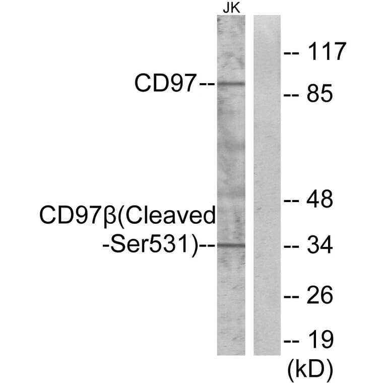 Western Blot - Anti-CD97 beta (cleaved Ser531) Antibody (L0192) - Antibodies.com