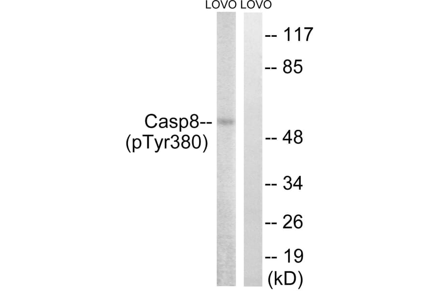 Western Blot - Anti-Caspase 8 (phospho Tyr380) Antibody (A8011) - Antibodies.com