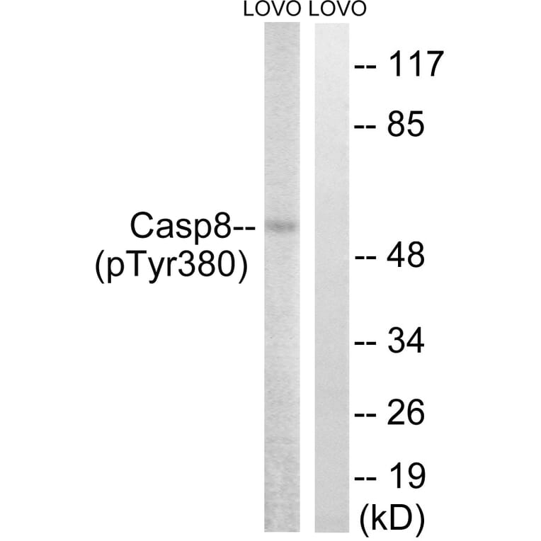 Western Blot - Anti-Caspase 8 (phospho Tyr380) Antibody (A8011) - Antibodies.com