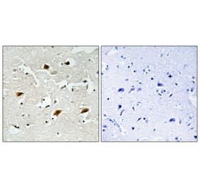 Immunohistochemistry - Anti-p27 Kip1 (phospho Thr157) Antibody (A0964) - Antibodies.com