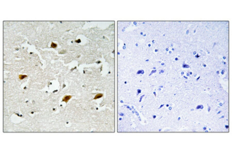 Immunohistochemistry - Anti-p27 Kip1 (phospho Thr157) Antibody (A0964) - Antibodies.com