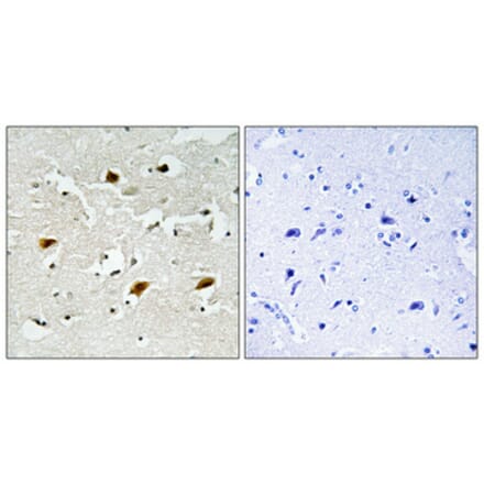 Immunohistochemistry - Anti-p27 Kip1 (phospho Thr157) Antibody (A0964) - Antibodies.com