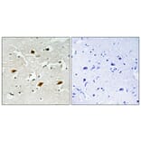 Immunohistochemistry - Anti-p27 Kip1 (phospho Thr157) Antibody (A0964) - Antibodies.com