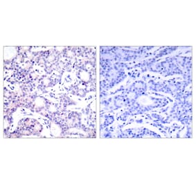 Immunohistochemistry - Anti-NF kappa B p105 / p50 Antibody (B7167) - Antibodies.com