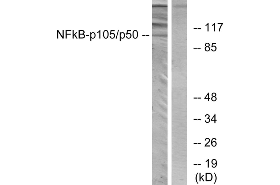 Western Blot - Anti-NF kappa B p105 / p50 Antibody (B7167) - Antibodies.com
