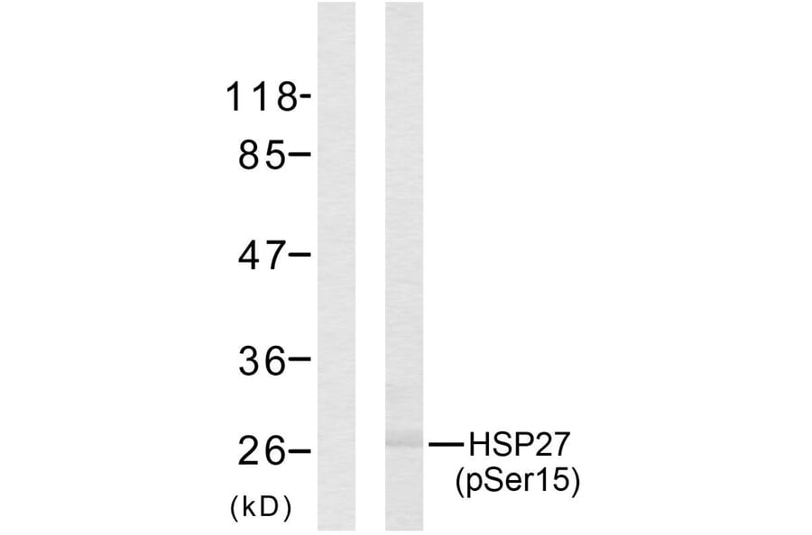 Western Blot - Anti-HSP27 (phospho Ser15) Antibody (A7110) - Antibodies.com