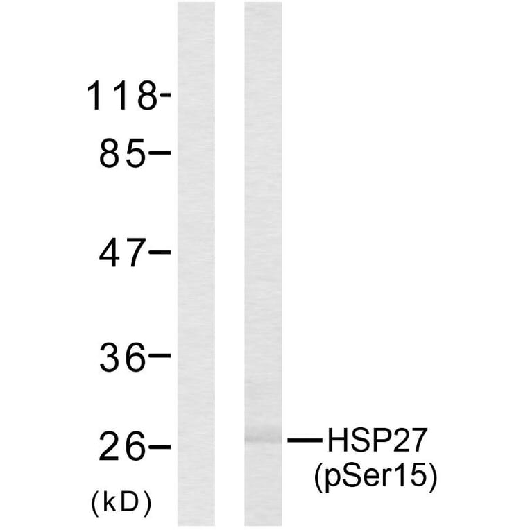 Western Blot - Anti-HSP27 (phospho Ser15) Antibody (A7110) - Antibodies.com