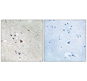 Immunohistochemistry - Anti-FLT3 (phospho Tyr969) Antibody (A8108) - Antibodies.com