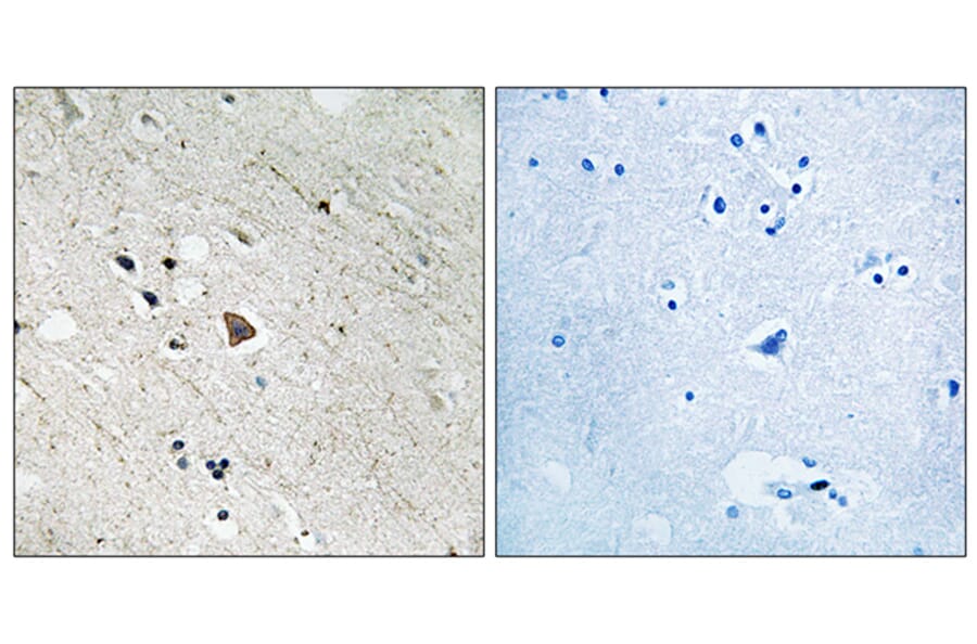 Immunohistochemistry - Anti-FLT3 (phospho Tyr969) Antibody (A8108) - Antibodies.com