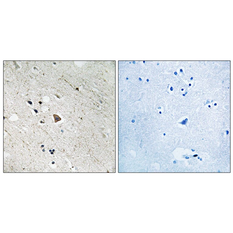 Immunohistochemistry - Anti-FLT3 (phospho Tyr969) Antibody (A8108) - Antibodies.com