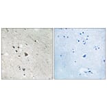 Immunohistochemistry - Anti-FLT3 (phospho Tyr969) Antibody (A8108) - Antibodies.com