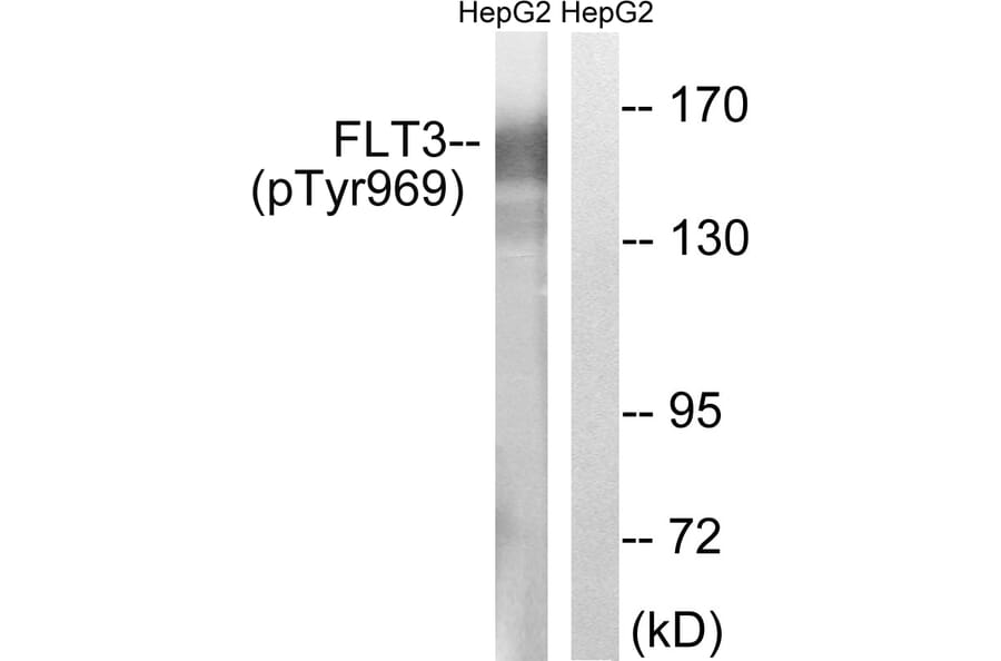 Western Blot - Anti-FLT3 (phospho Tyr969) Antibody (A8108) - Antibodies.com