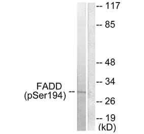 Western Blot - Anti-FADD (phospho Ser194) Antibody (A0425) - Antibodies.com