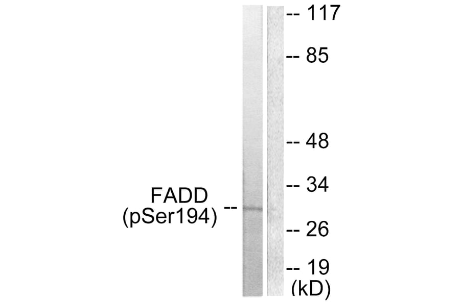 Western Blot - Anti-FADD (phospho Ser194) Antibody (A0425) - Antibodies.com