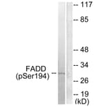 Western Blot - Anti-FADD (phospho Ser194) Antibody (A0425) - Antibodies.com