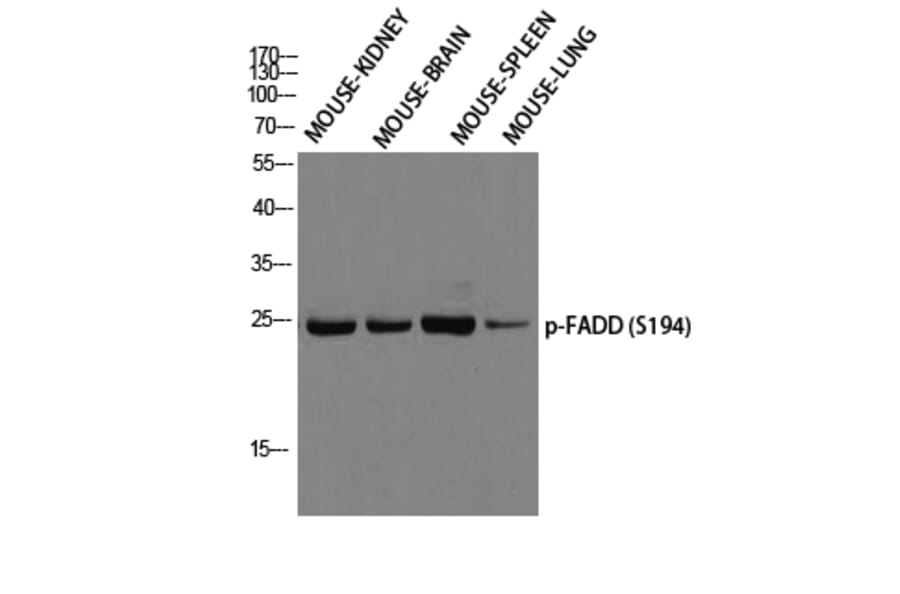 Western Blot - Anti-FADD (phospho Ser194) Antibody (A0425) - Antibodies.com