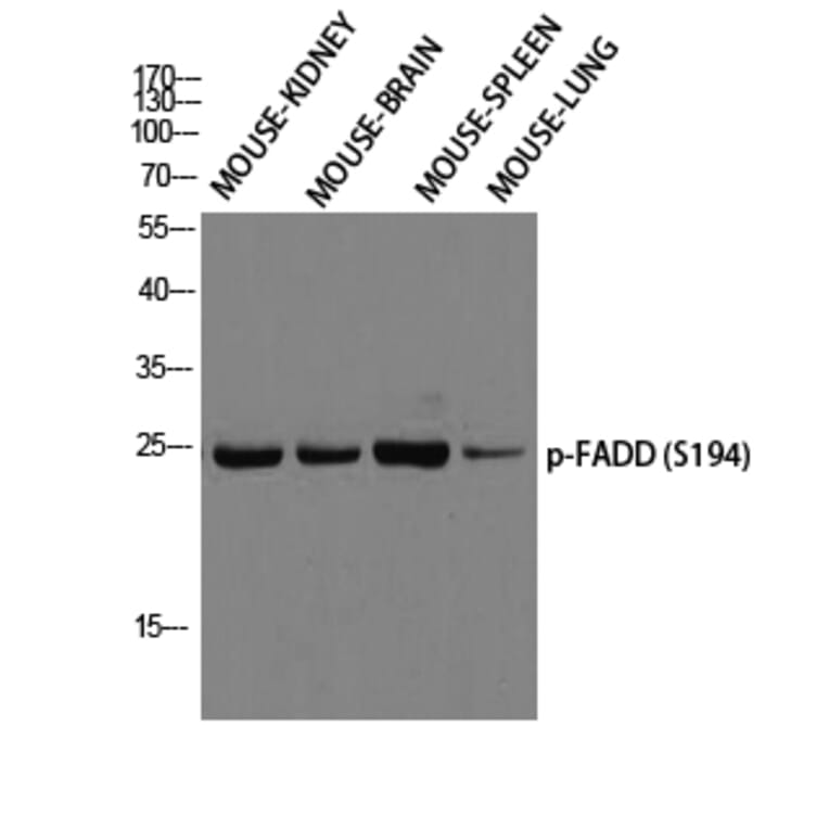 Western Blot - Anti-FADD (phospho Ser194) Antibody (A0425) - Antibodies.com