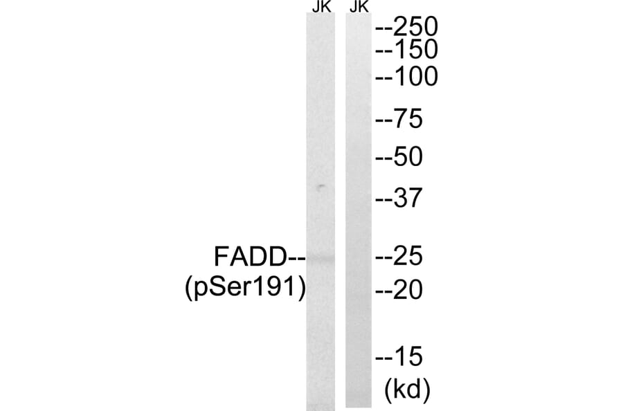 Western Blot - Anti-FADD (phospho Ser191) Antibody (A8503) - Antibodies.com