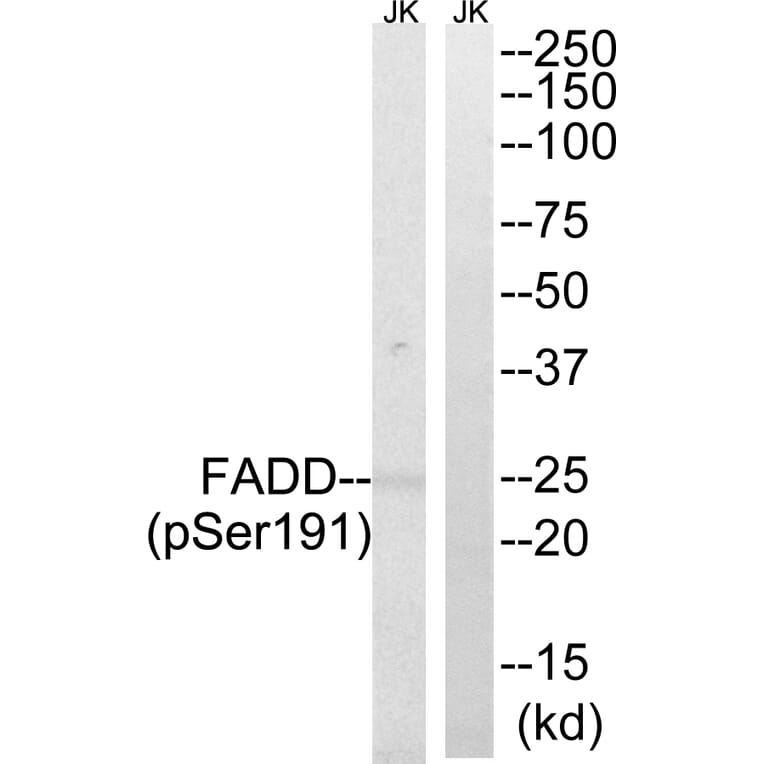 Western Blot - Anti-FADD (phospho Ser191) Antibody (A8503) - Antibodies.com