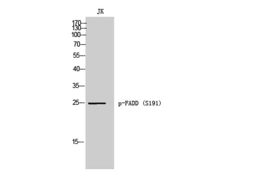Western Blot - Anti-FADD (phospho Ser191) Antibody (A8503) - Antibodies.com
