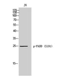 Western Blot - Anti-FADD (phospho Ser191) Antibody (A8503) - Antibodies.com