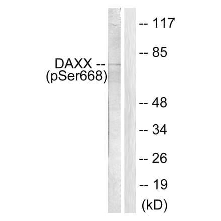 Western Blot - Anti-Daxx (phospho Ser668) Antibody (A0419) - Antibodies.com