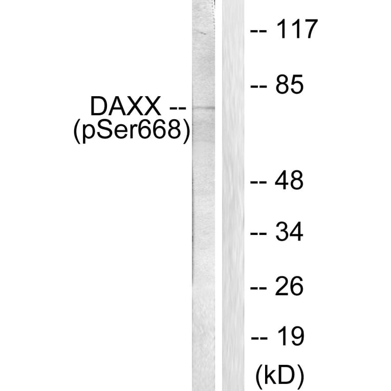 Western Blot - Anti-Daxx (phospho Ser668) Antibody (A0419) - Antibodies.com