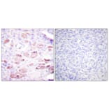 Immunohistochemistry - Anti-Daxx (phospho Ser668) Antibody (A0419) - Antibodies.com