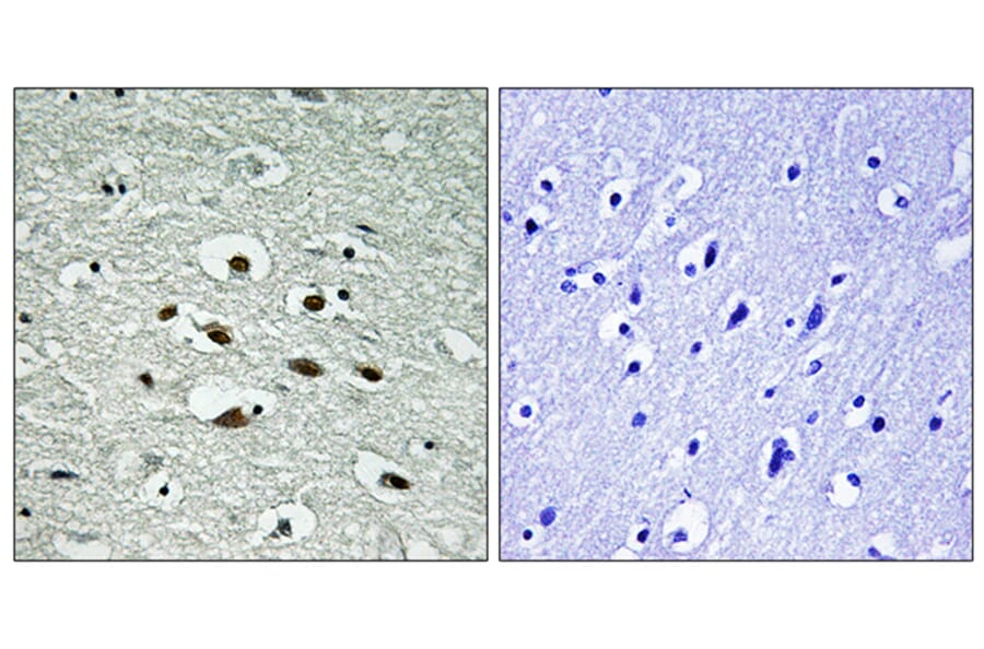 Immunohistochemistry - Anti-Chk1 (phospho Ser296) Antibody (A0629) - Antibodies.com