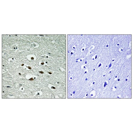 Immunohistochemistry - Anti-Chk1 (phospho Ser296) Antibody (A0629) - Antibodies.com