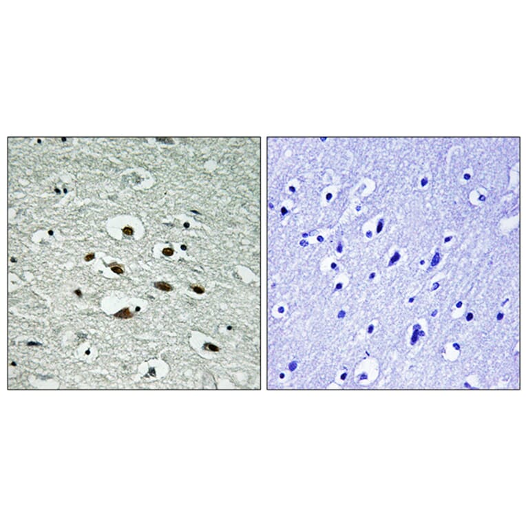 Immunohistochemistry - Anti-Chk1 (phospho Ser296) Antibody (A0629) - Antibodies.com