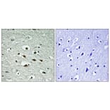 Immunohistochemistry - Anti-Chk1 (phospho Ser296) Antibody (A0629) - Antibodies.com