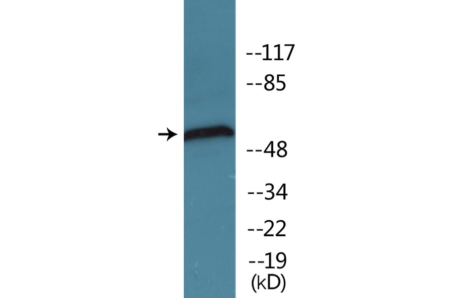 Western Blot - Anti-Chk1 (phospho Ser296) Antibody (P12-1091) - Antibodies.com