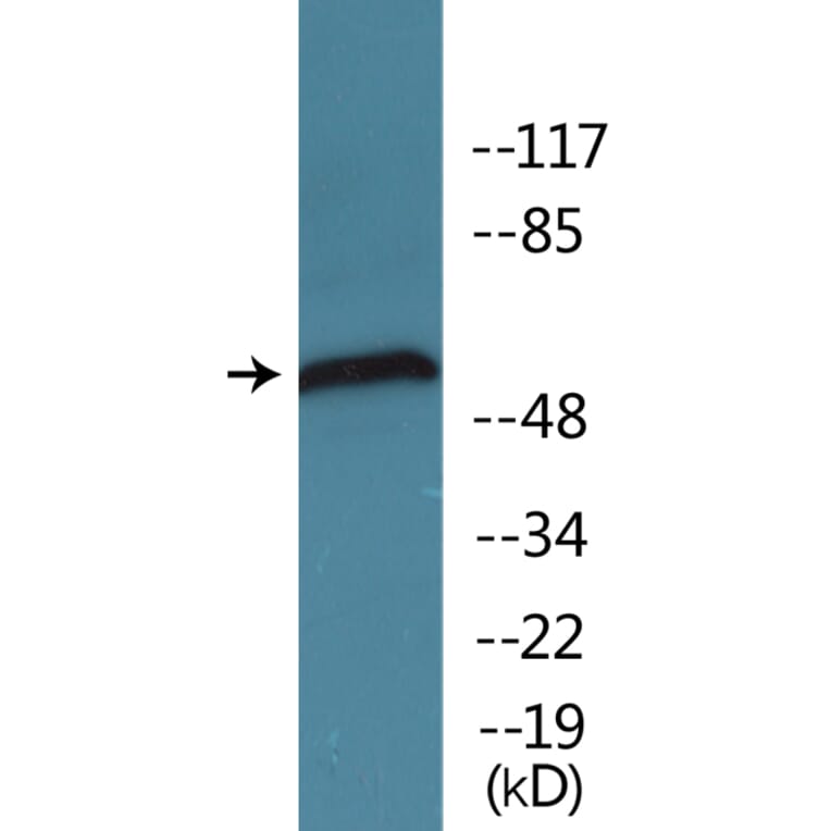 Western Blot - Anti-Chk1 (phospho Ser296) Antibody (P12-1091) - Antibodies.com