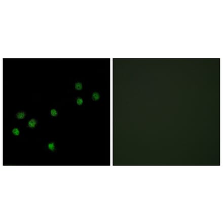 Immunofluorescence - Anti-Centromeric Protein A Antibody (B0858) - Antibodies.com
