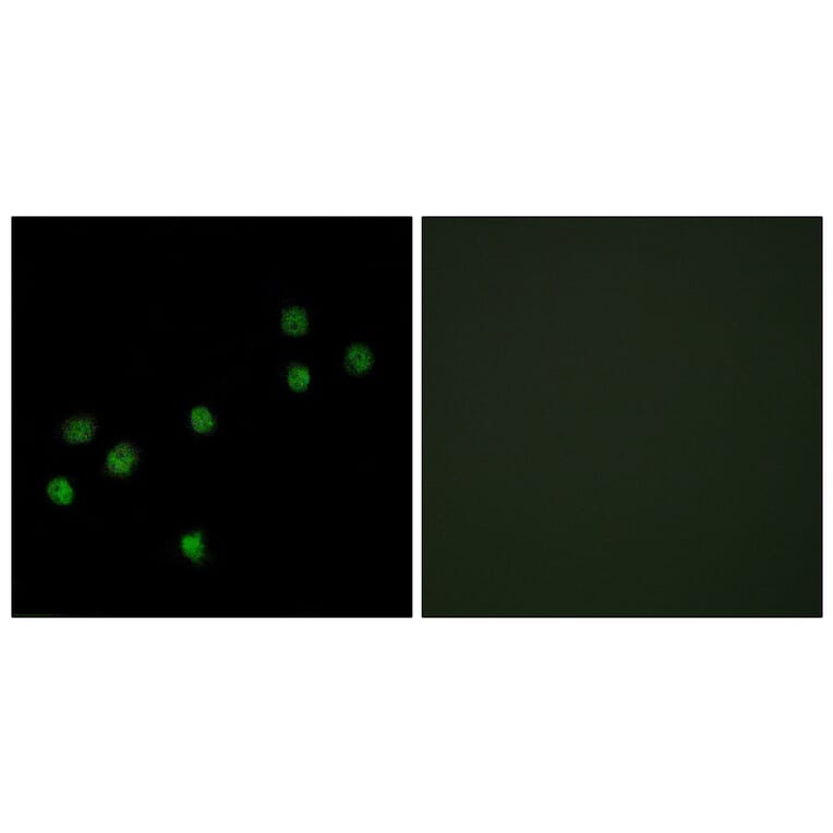 Immunofluorescence - Anti-Centromeric Protein A Antibody (B0858) - Antibodies.com