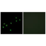 Immunofluorescence - Anti-Centromeric Protein A Antibody (B0858) - Antibodies.com