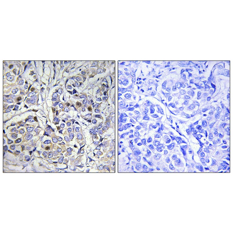 Immunohistochemistry - Anti-Centromeric Protein A Antibody (B0858) - Antibodies.com